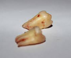 Cirurgia Atuação