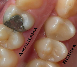 Dentistica Atuação