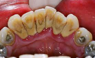 PERIODONTIA Atuação